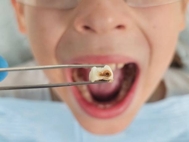 Best After-Hours Dental Care in Keene, TX